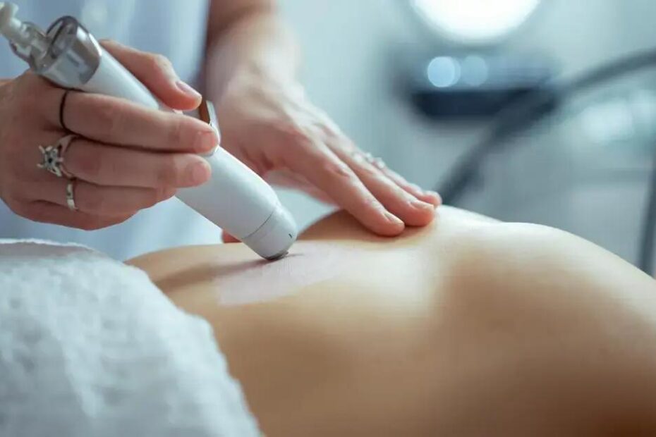 Como acelerar o metabolismo com estética: descubra tratamentos que realmente funcionam