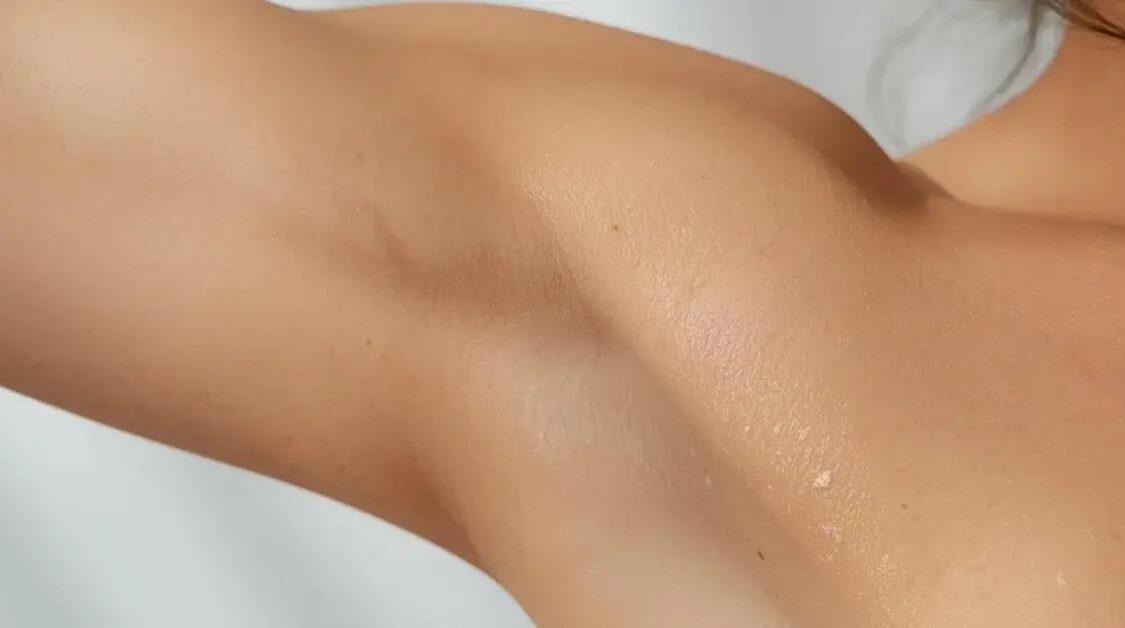 Como clarear axila na clínica: os tratamentos mais eficazes para uma pele uniforme