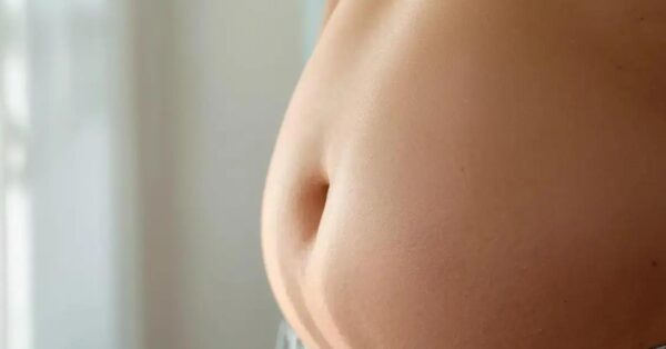 Home 2 Estrias na barriga tratamento: descubra as opções eficazes e diga adeus de vez