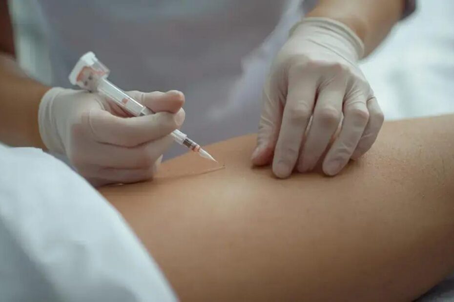Intradermoterapia: o que é e como funciona para celulite e gordura localizada?