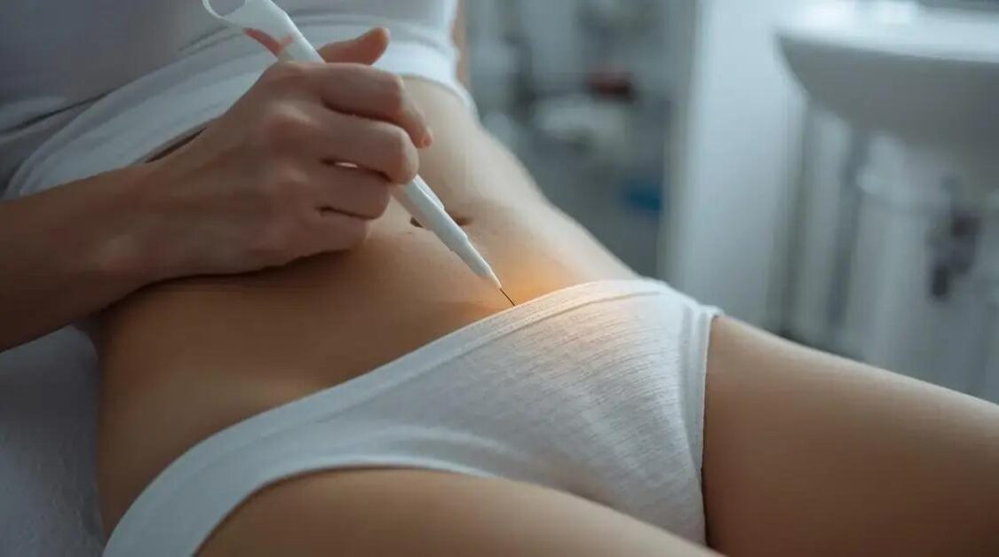 Intradermoterapia para emagrecer: é a solução ideal para você?